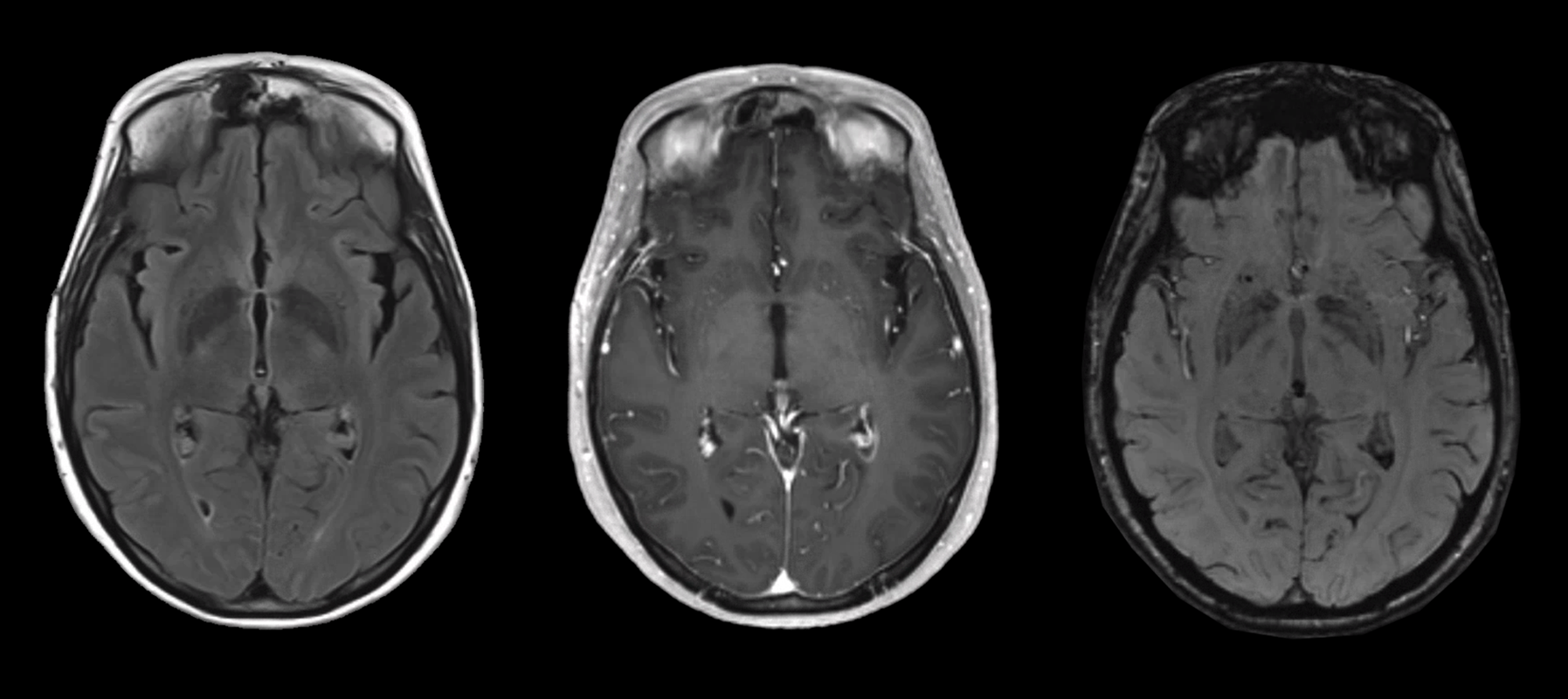 MRI sequences part 2