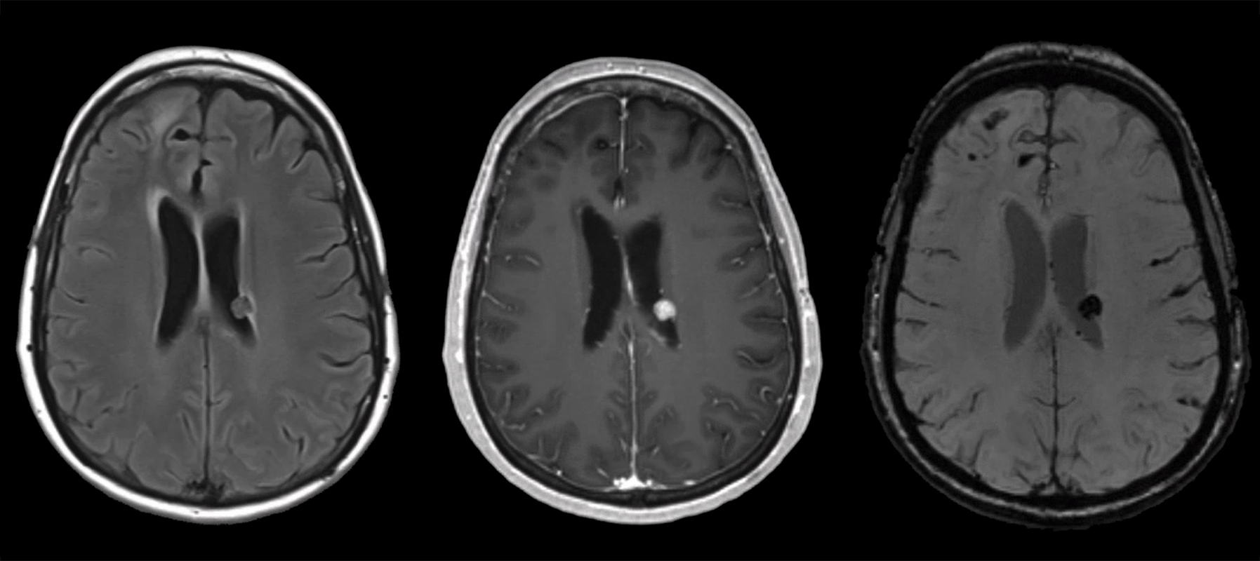 MRI sequences part 3