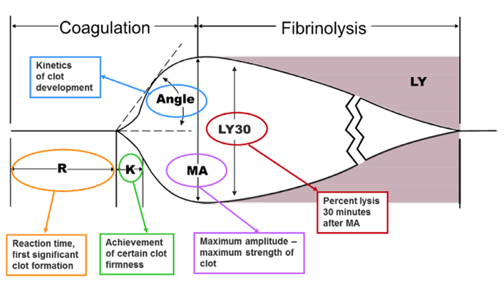 Annotated ROTEM tracing